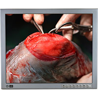 Additional charge HD camera Sony centrally mounted in the light body incl. remote control